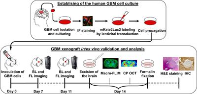 Highly Invasive Fluorescent/Bioluminescent Patient-Derived Orthotopic Model of Glioblastoma in Mice